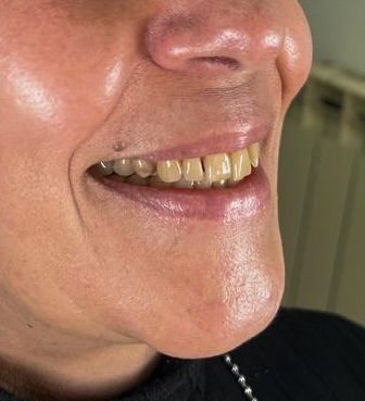 Mujer en cirugía oral